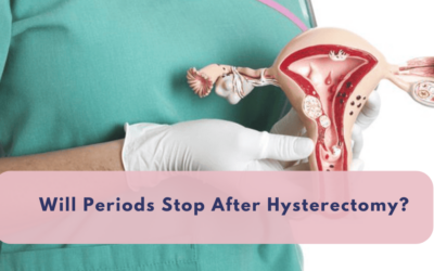 Will Periods Stop Immediately After Hysterectomy?