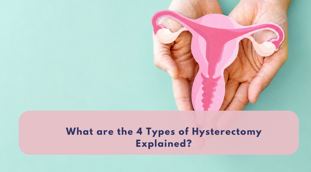What are the 4 Types of Hysterectomy Explained