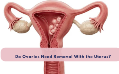 Do Ovaries Need Removal With the Uterus?