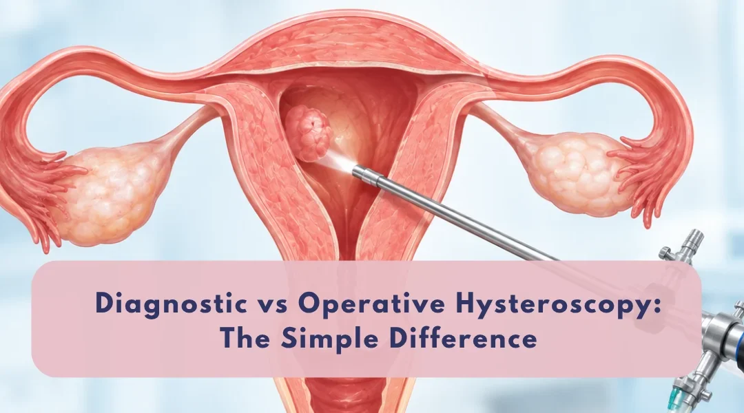 Diagnostic vs Operative Hysteroscopy The Simple Difference